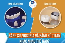 Răng Sứ Zirconia và Răng Sứ Titan Khác Nhau Thế Nào
