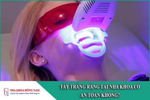 tẩy trắng răng tại nha khoa có an toàn không