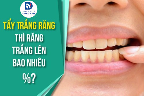 Tẩy Trắng Răng thì răng trắng lên bao nhiêu phần trăm