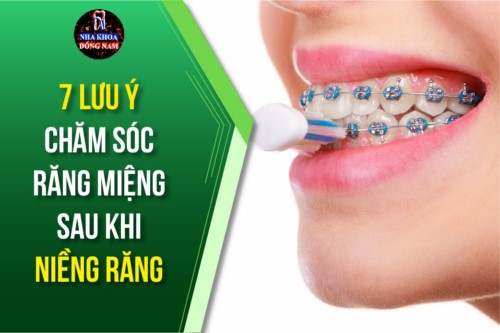 Những lưu ý chăm sóc răng miệng sau khi niềng răng