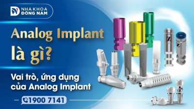 Analog Implant là gì vai trò và ứng dụng trong Implant
