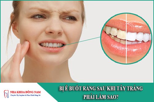bị ê buốt răng sau khi tẩy trắng phải làm sao