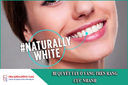 bí quyết tẩy ố vàng trên răng cực nhanh