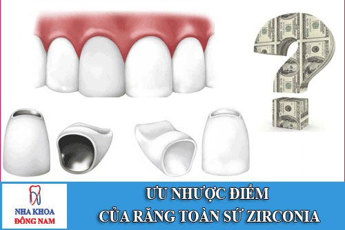 bọc răng sứ có đắt không