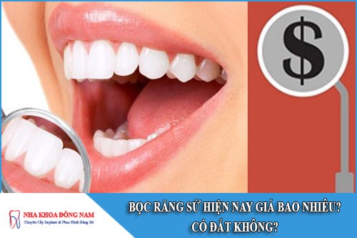 bọc răng sứ hiện nay giá bao nhiêu