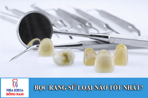 bọc răng sứ loại nào tốt nhất