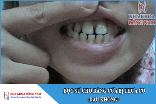 bọc sứ cho răng của bị thưa có đau không