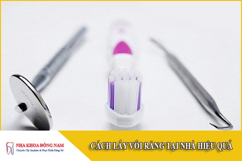 cách lấy vôi răng tại nhà hiệu quả