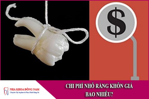 chi phí nhổ răng khôn giá bao nhiêu