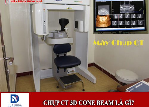 Chụp CT 3D Cone Beam là gì và có gây hại cho cơ thể không?