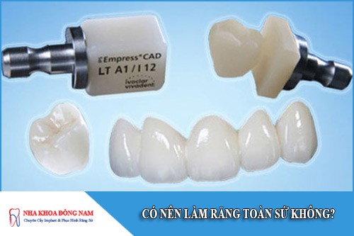 có nên làm răng toàn sứ hay không