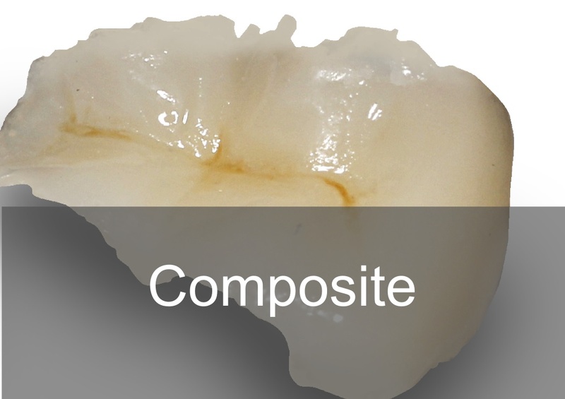 Composite là một loại vật liệu tổng hợp