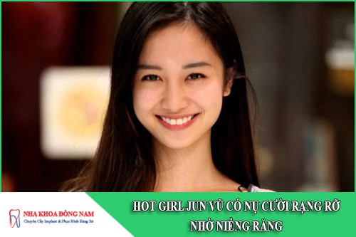 hot girl jun vũ có nụ cười rạng rỡ nhờ niềng răng