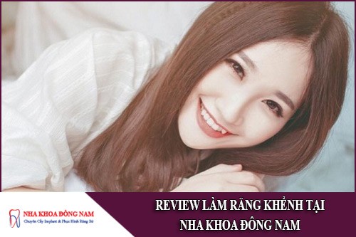 review làm răng khểnh tại nha khoa đông nam