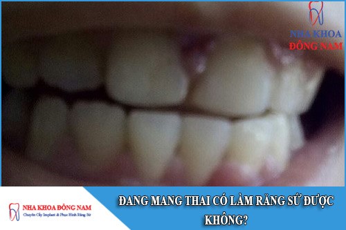 đang mang thai có làm răng sứ được không