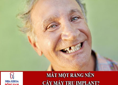 mất một răng nên cấy mấy trụ implant 1