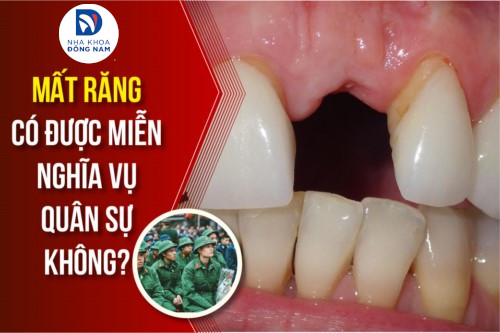 Mất răng có được miễn Nghĩa Vụ Quân Sự không? - Nha Khoa Đông Nam®