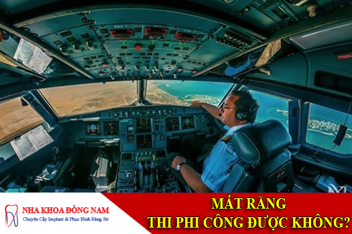 mất răng có thi phi công được không -1