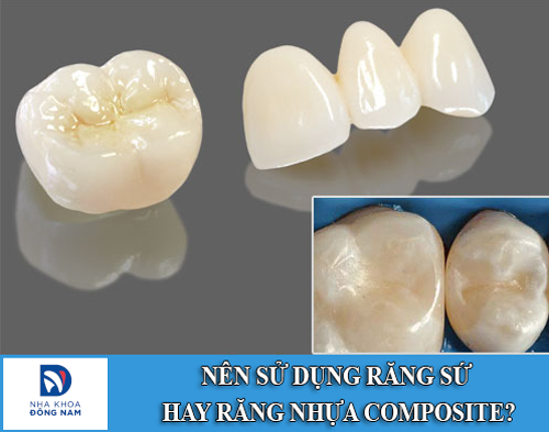 Nên chọn sử dụng răng sứ hay răng nhựa composite