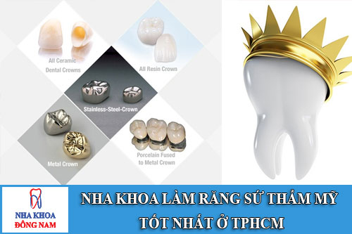 nha khoa làm răng sứ thẩm mỹ tốt nhất ở tp.hcm