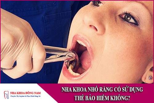 nha khoa nhổ răng có sử dụng thẻ bảo hiểm không