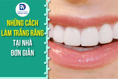 Cách làm trắng răng bị ố vàng tại nhà và cách giữ cho răng trắng sáng