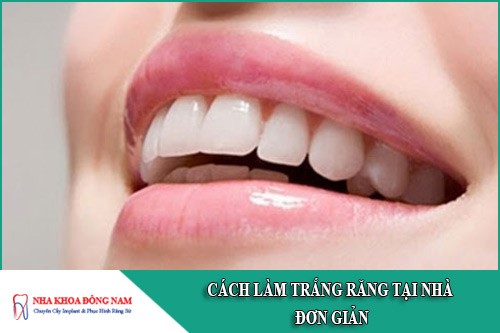 Những cách làm trắng răng tại nhà đơn giản