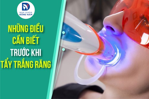 Những điều cần biết trước khi tẩy trắng răng
