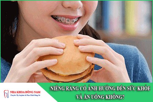 niềng răng có ảnh hưởng đến sức khỏe và ăn uống không