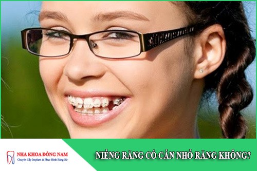 niềng răng có cần nhổ răng không