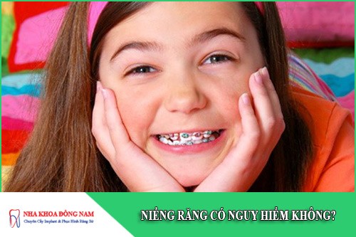 niềng răng có nguy hiểm không