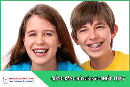 niềng răng hô giá bao nhiêu tiền