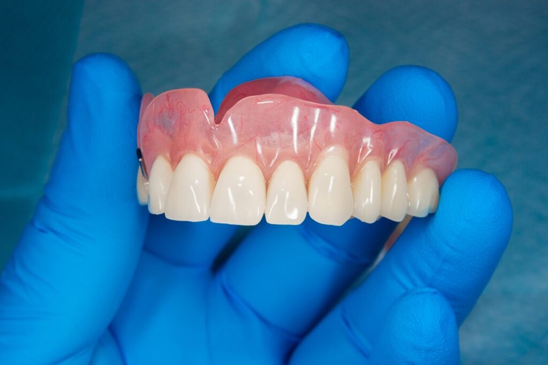 Phần răng giả Composite ứng dụng cho trường hợp mất răng toàn hàm
