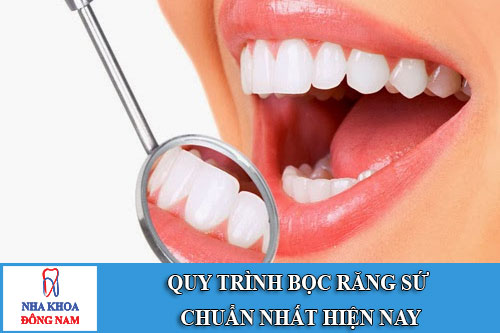 quy trình bọc răng sứ chuẩn nhất hiện nay