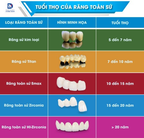 tuổi thọ của các loại răng sứ