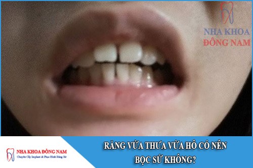 răng vừa thưa vừa hô có nên bọc sứ không