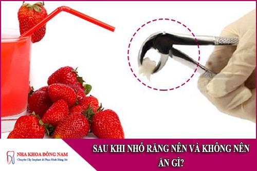 sau khi nhổ răng nên và không nên ăn gì