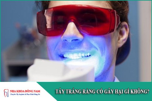tẩy trắng răng có gây hại gì không