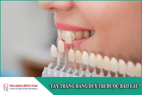 tẩy trắng răng duy trì được bao lâu