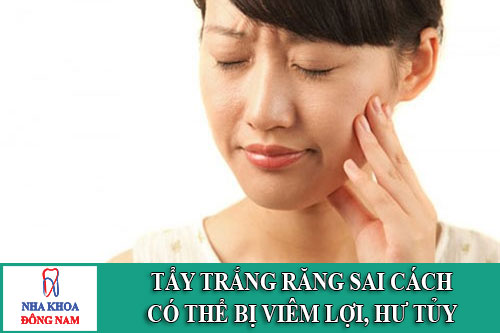 tẩy trắng răng sai cách có thể bị viêm lơi hưu tủy