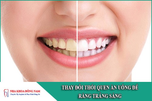 thay đổi thói quen ăn uống để răng trắng sáng