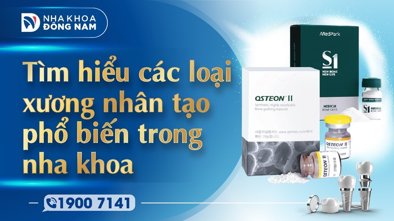 Tìm hiểu các loại xương nhân tạo phổ biến trong nha khoa