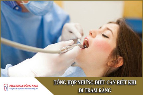 tổng hợp những điều cần biết khi đi trám răng