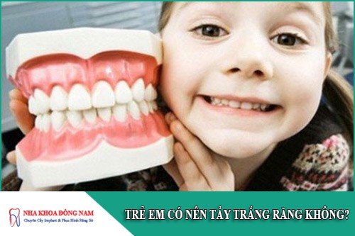 trẻ em có nên tẩy trắng răng không