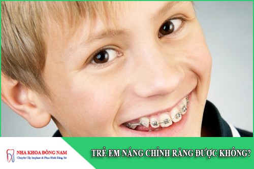 trẻ em nắn chỉnh răng được không