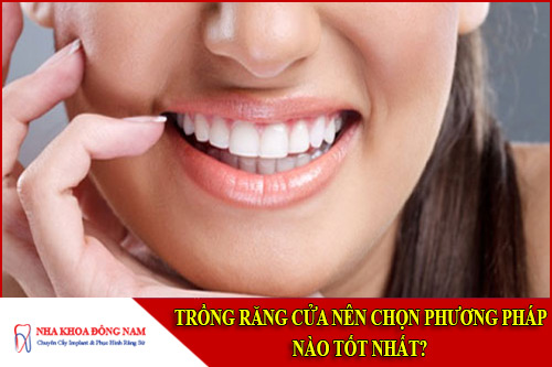 Trồng Răng Cửa Nên Chọn Phương Pháp Nào Tốt Nhất?