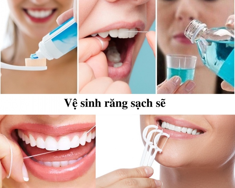Vệ sinh răng sứ sạch sẽ kéo dài tuổi thọ lâu hơn