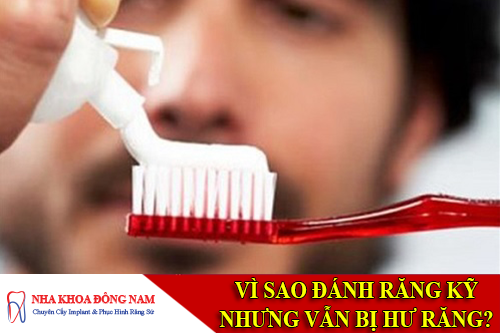 vì sao đánh răng rất kỹ nhưng vẫn bị hư răng -1