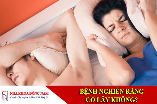 benh nghien rang co lay khong