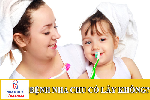 bệnh nha chu có lây không